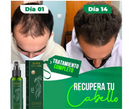 ELHOE Tónico Capilar - Elixir para un cabello espectacular (Barba, Pelo y Cejas)