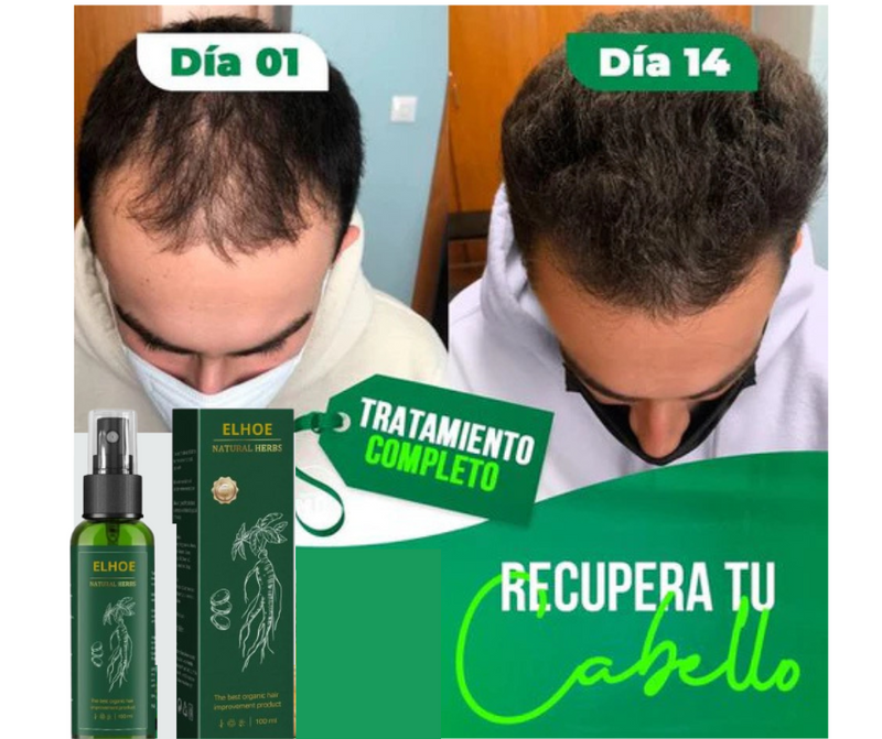 ELHOE Tónico Capilar - Elixir para un cabello espectacular (Barba, Pelo y Cejas)